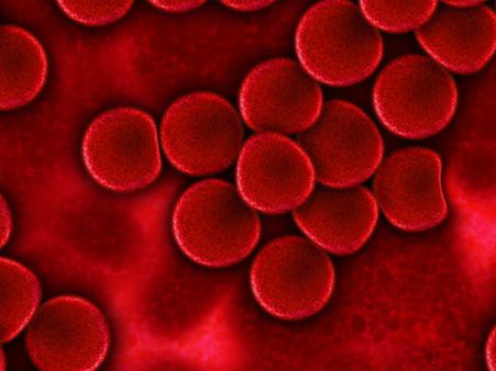 ১. গাড় লাল ক্লট: ১. গাড় লাল ক্লট: