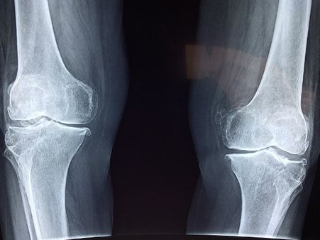 ২. হাড়কে শক্তপোক্ত করে: ২. হাড়কে শক্তপোক্ত করে: