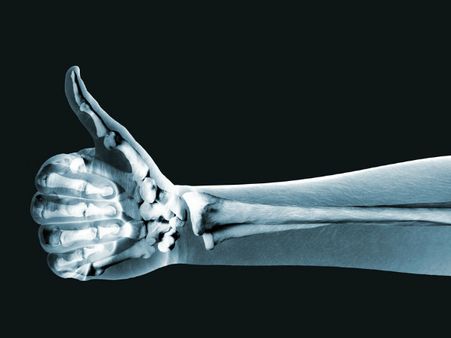 ৪. হাড় শক্তপোক্ত হয়: