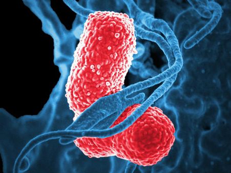 ৭.সংক্রমণের আশঙ্কা থাকে: