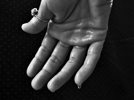 ৬. বেশি ঘামলে: