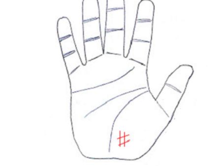 ১. নেটের মতো দাগ: