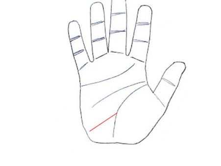 ৪. লাইফলাইনের বেঁকে যাওয়া: