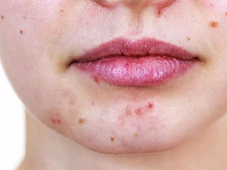 নো মেকআপ 