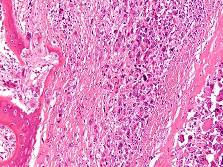 রোগের লক্ষণ