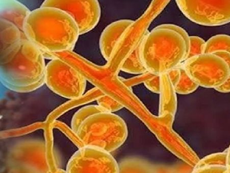 ইয়েলো ফাঙ্গাস