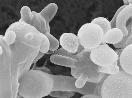 হোয়াইট ফাঙ্গাস