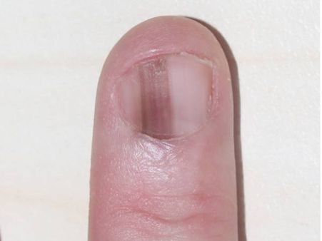 এর জন্য কি চিকিৎসকের পরামর্শ নেওয়া উচিত?