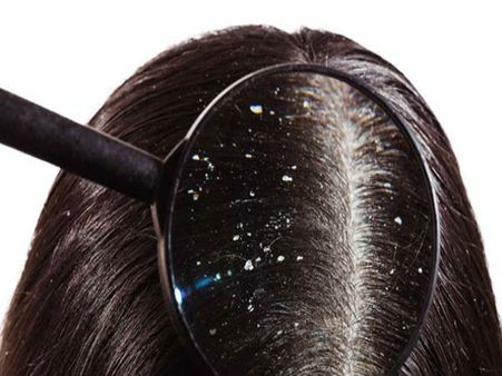 খুশকির জন্য তুলসীর হেয়ার মাস্ক