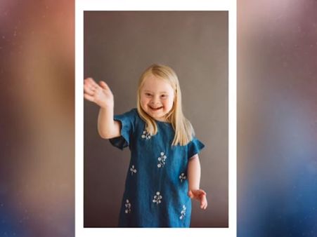 ডাউন সিন্ড্রোম কী (What is Down syndrome)?