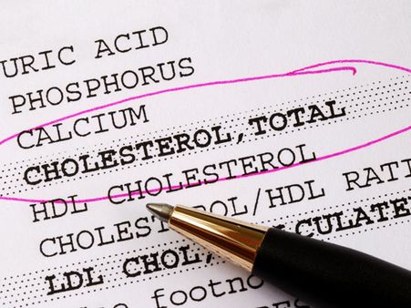 Regular Check On Cholesterol Regular Check On Cholesterol
