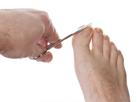 Not cutting toenails