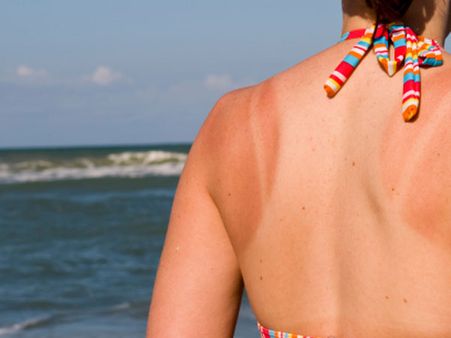 Mole On Left Shoulder