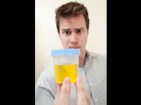 Urine addiction