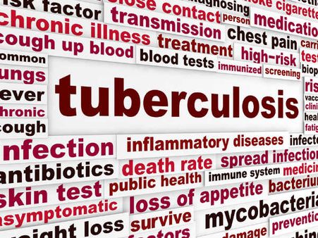 Tuberculosis