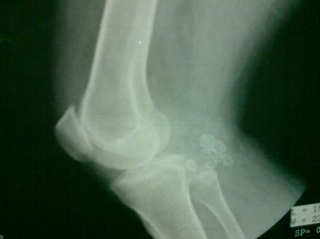 Electromagnetic waves 