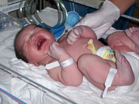 Resents Communal Care