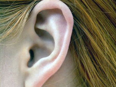 Difficulty in hearing