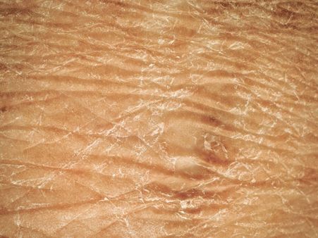 Pumice Stone For Dry Skin