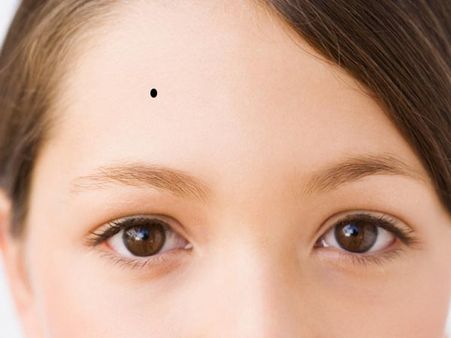 Moles And Spots Become Prominent