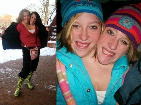 Abigail And Brittany Hensel 