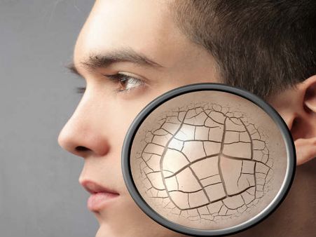 Dry Skin Becomes Vulnerable