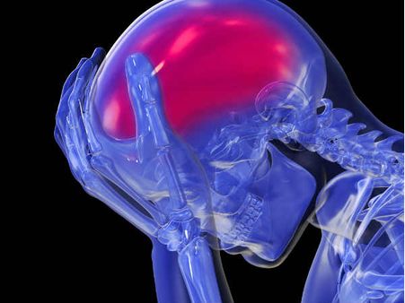 Prevent Strokes Prevent Strokes