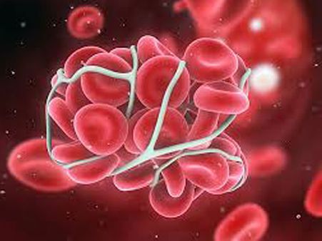 8. RBC clotting due to Soy. Don’t be surprised!