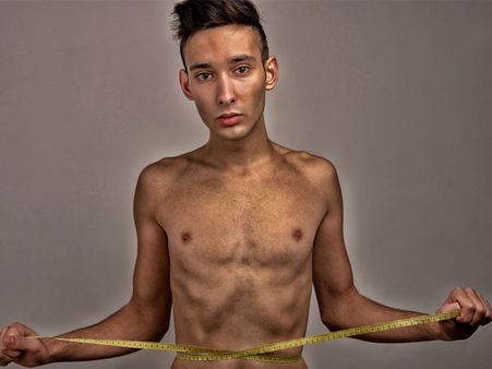 Malnutrition: Malnutrition: