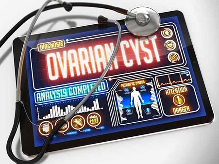 Types Of Cysts