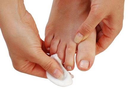 Toe Shaving
