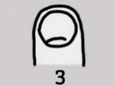 Uneven And Short Nails