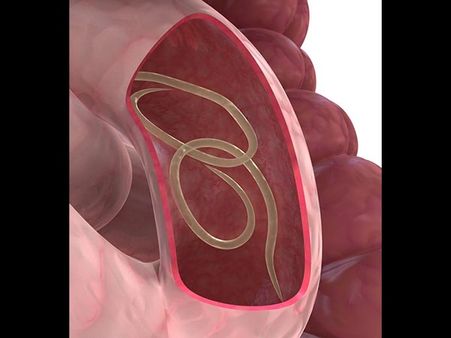 How Intestinal Parasites Enter The Body?