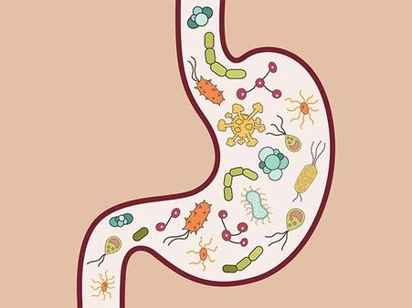 Do They Occur In Underdeveloped Countries Only? 