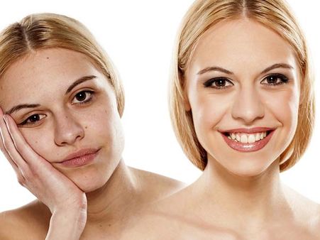 Comparing Yourself To Other People