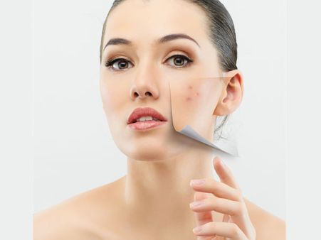 Benefits Of Avocado Facial