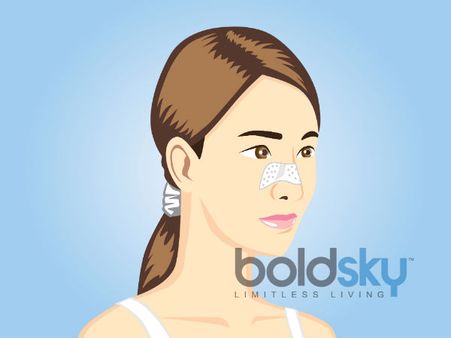 Nasal Adhesive Strips