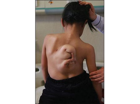 The Girl With A Foetus On Her Back