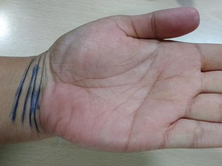 The Number Of Bracelets