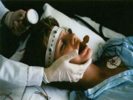 Electroconvulsive Treatment (ECT)