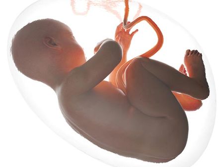 A Prolapsed Umbilical Cord: 