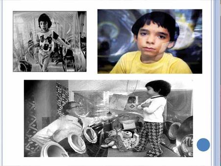 Severe Combined Immunodeficiency Disorder (SCID)