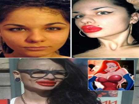 The Woman Who Wanted To Look Like “Jessica Rabbit” The Woman Who Wanted To Look Like “Jessica Rabbit”