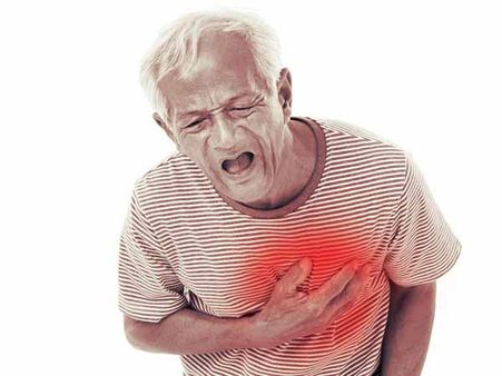 Chest Pain Makes An Appearance: Chest Pain Makes An Appearance: