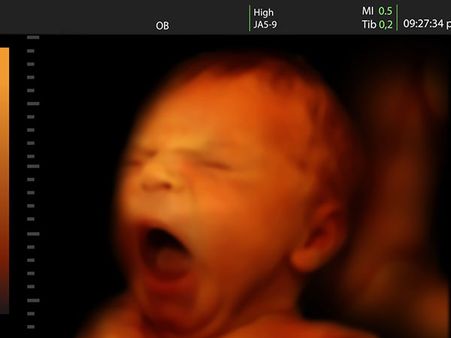 Yawning In The Womb: 