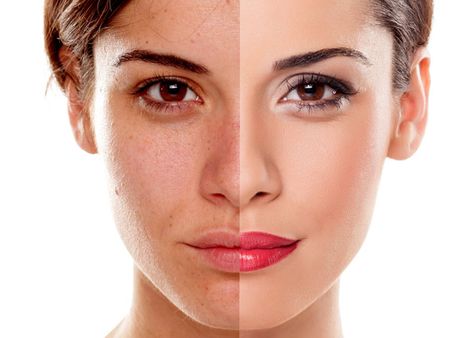 4. Improves Complexion 4. Improves Complexion