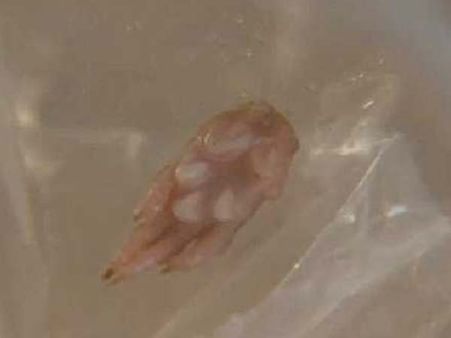 Rat's Foot Found In A Baby's Food Rat's Foot Found In A Baby's Food