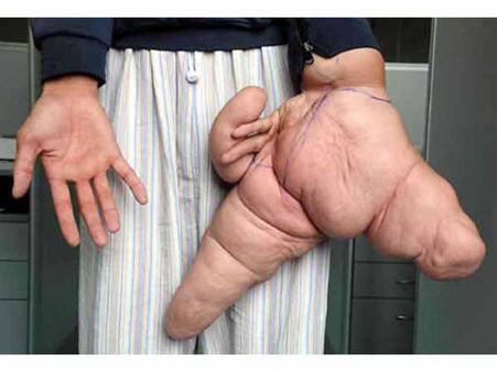 World's Largest Hand World's Largest Hand