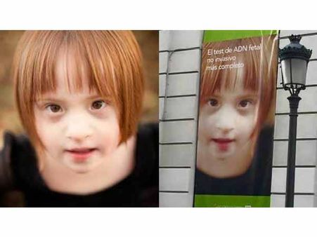 A Child's Picture With Down Syndrome Used In An Ad