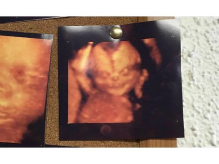 The Parents Who Were Scared With A Creepy Face The Parents Who Were Scared With A Creepy Face